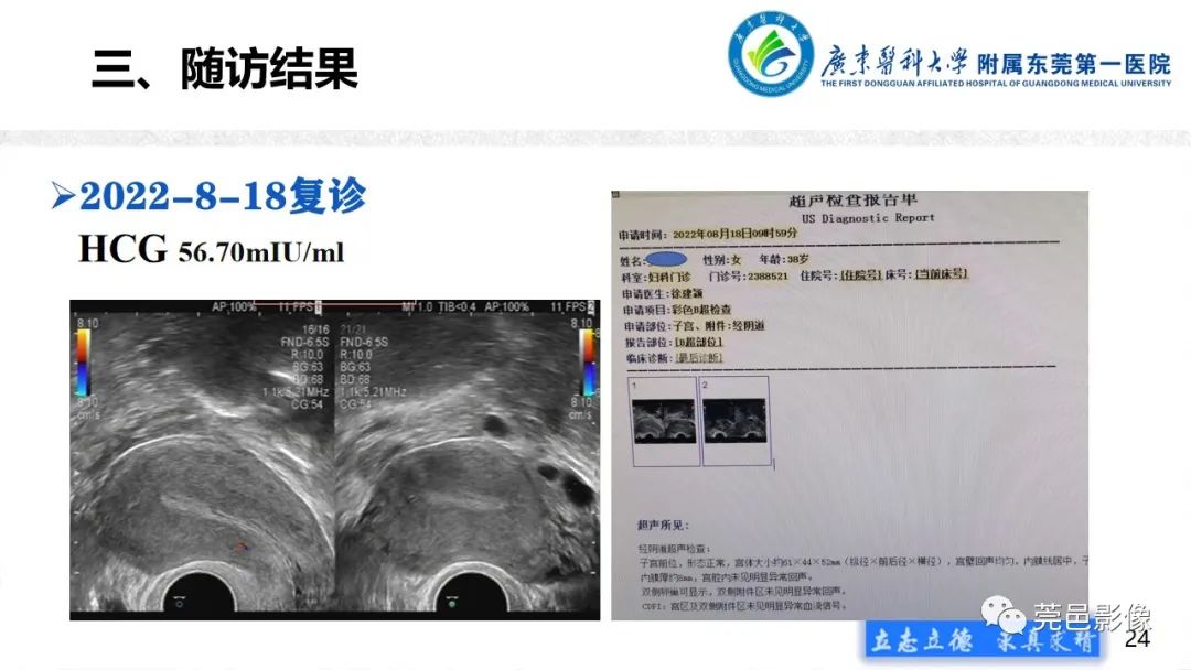 【病例】不全流产1例超声及MR影像-24