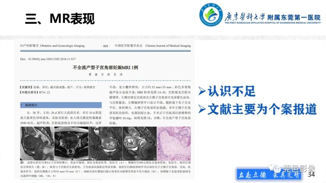 【病例】不全流产1例超声及MR影像-34