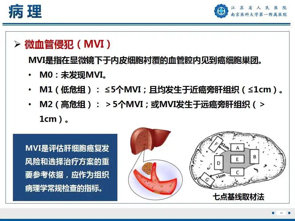 【PPT】肝细胞癌—肝脏肿瘤术前MR评估-25