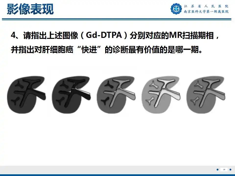 【PPT】肝细胞癌—肝脏肿瘤术前MR评估-26