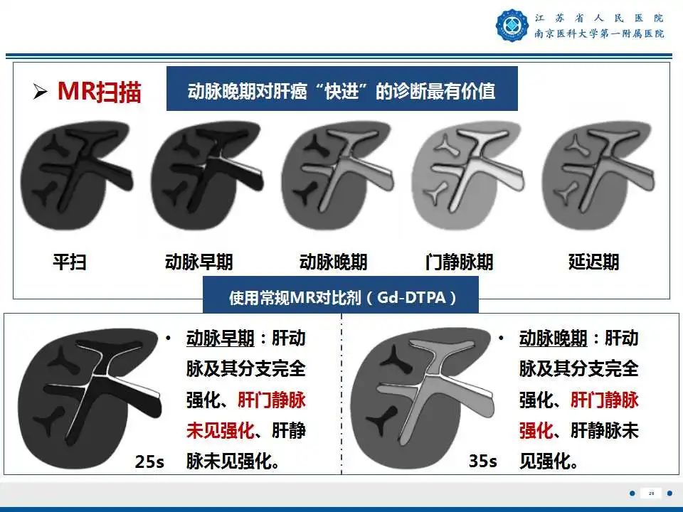 【PPT】肝细胞癌—肝脏肿瘤术前MR评估-27