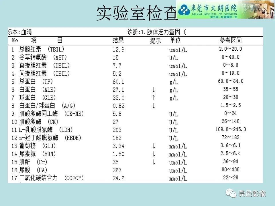 【病例】线粒体脑肌病1例CT及MR-3