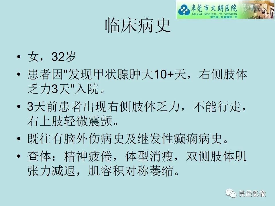 【病例】线粒体脑肌病1例CT及MR-2