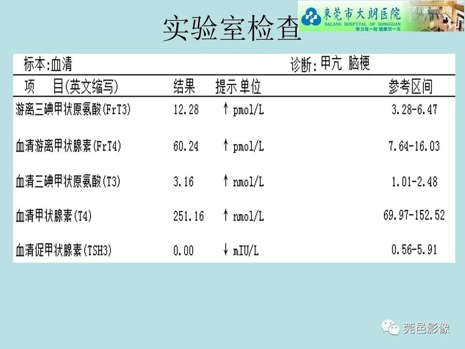 【病例】线粒体脑肌病1例CT及MR-4