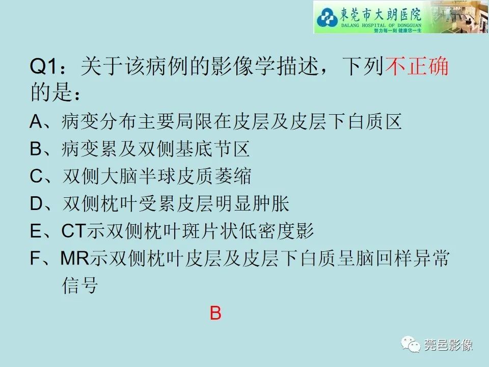 【病例】线粒体脑肌病1例CT及MR-14