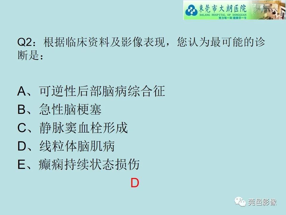 【病例】线粒体脑肌病1例CT及MR-15