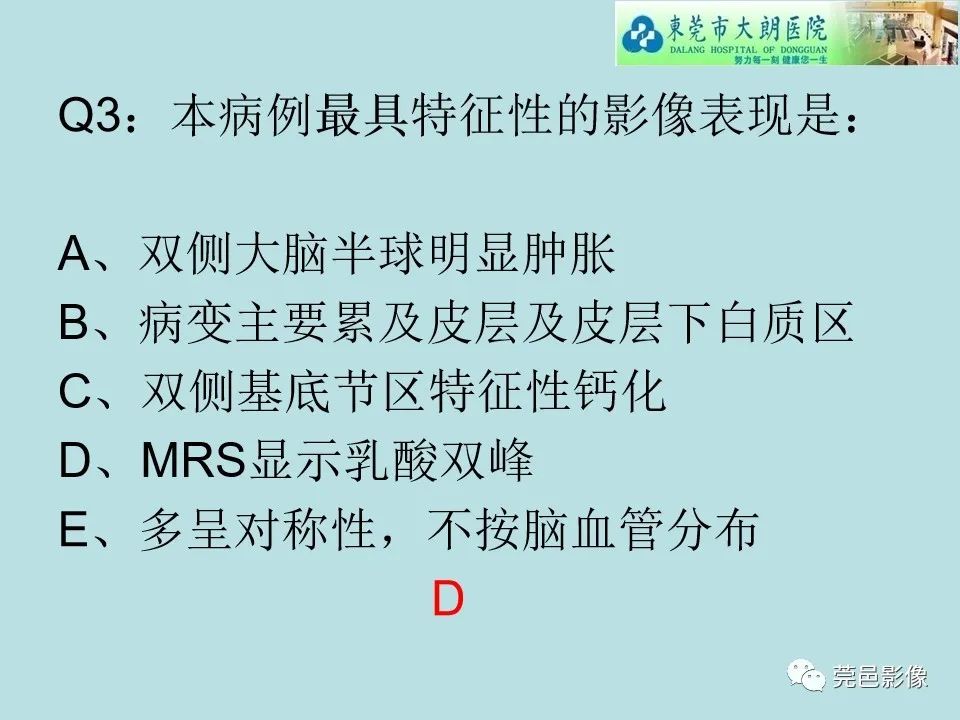 【病例】线粒体脑肌病1例CT及MR-16