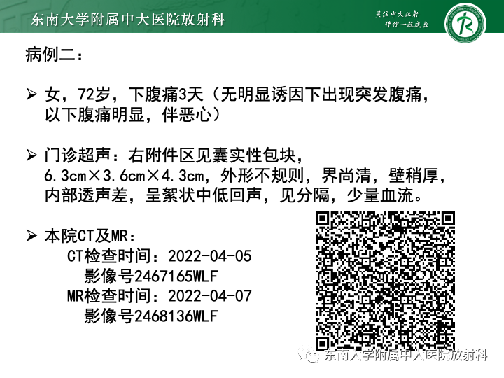 【病例】附件扭转4例病例随访-4