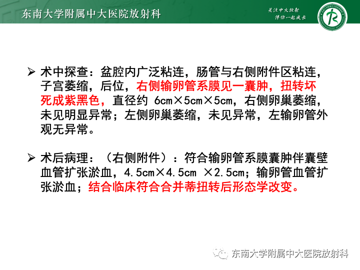 【病例】附件扭转4例病例随访-7