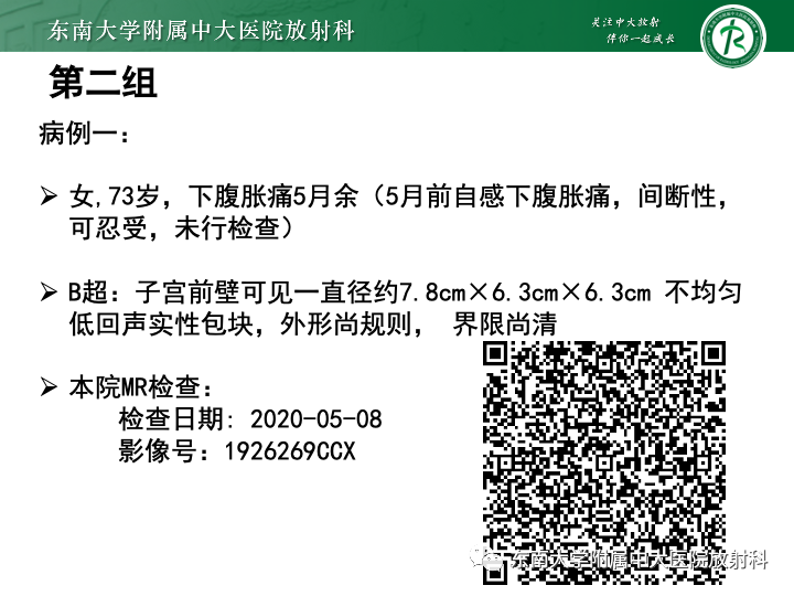 【病例】附件扭转4例病例随访-8
