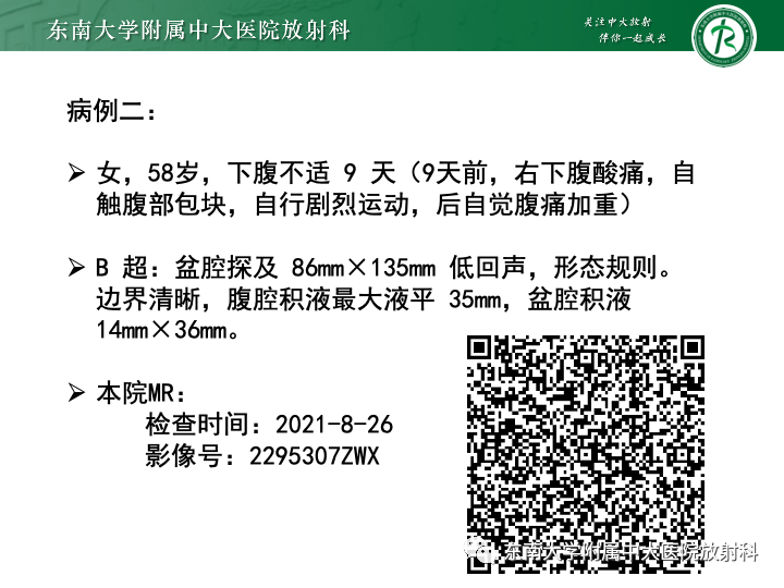 【病例】附件扭转4例病例随访-11