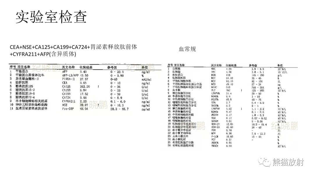 【PPT】儿童及青少年前纵隔肿瘤-3