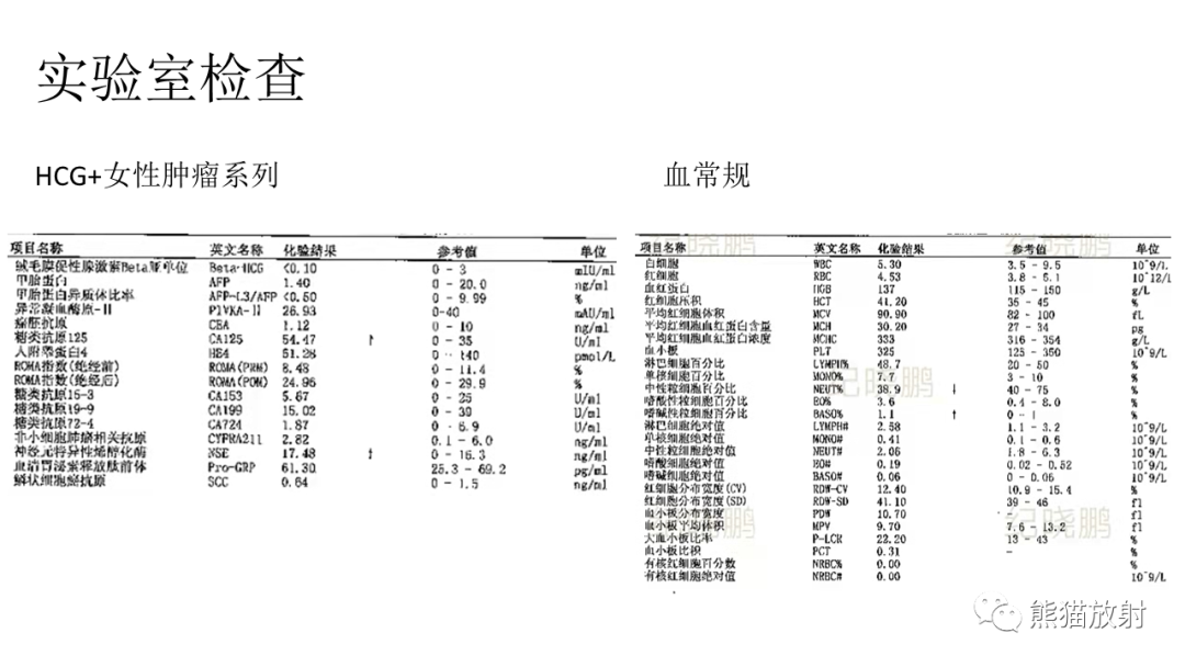 【PPT】儿童及青少年前纵隔肿瘤-8