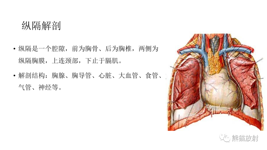 【PPT】儿童及青少年前纵隔肿瘤-15