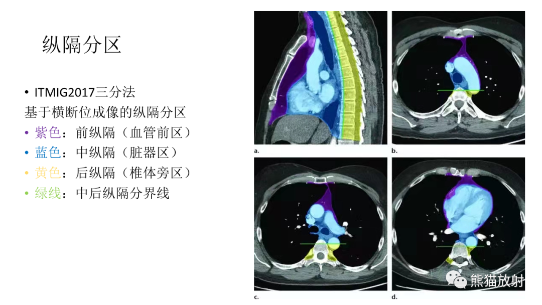 【PPT】儿童及青少年前纵隔肿瘤-16