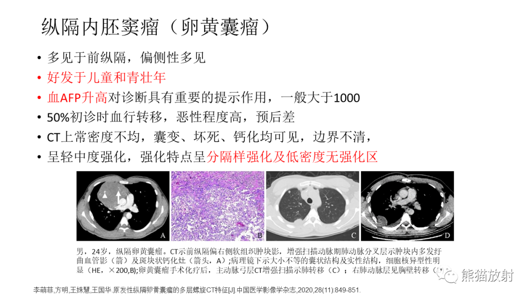 【PPT】儿童及青少年前纵隔肿瘤-32