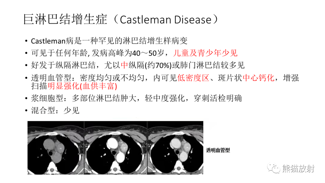【PPT】儿童及青少年前纵隔肿瘤-35