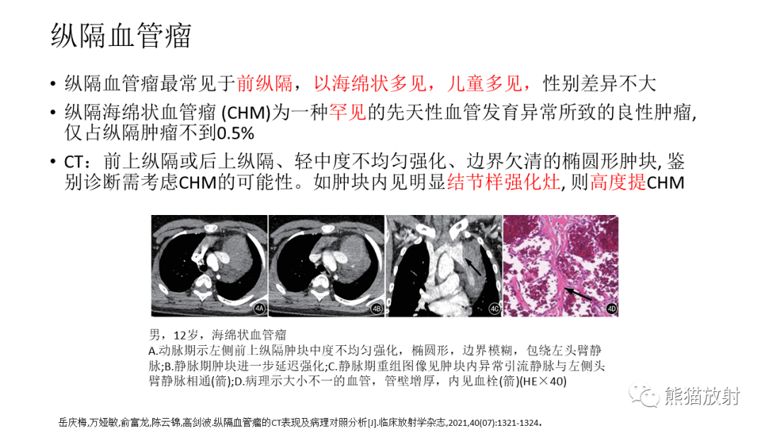 【PPT】儿童及青少年前纵隔肿瘤-37
