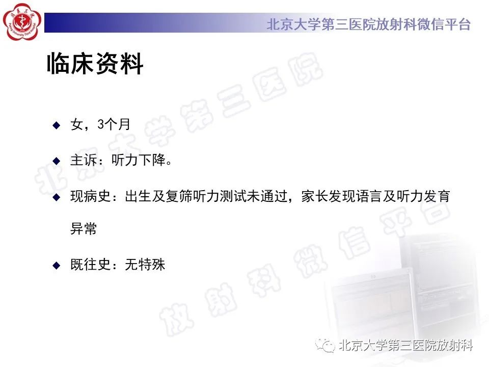 【PPT】内耳发育畸形-2