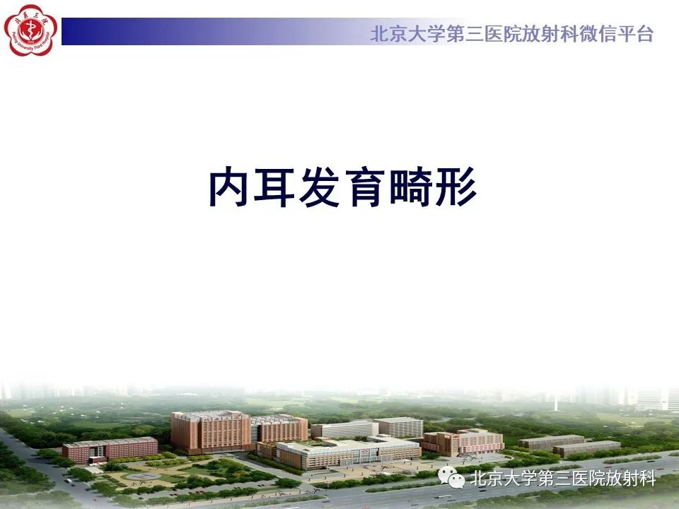 【PPT】内耳发育畸形-8