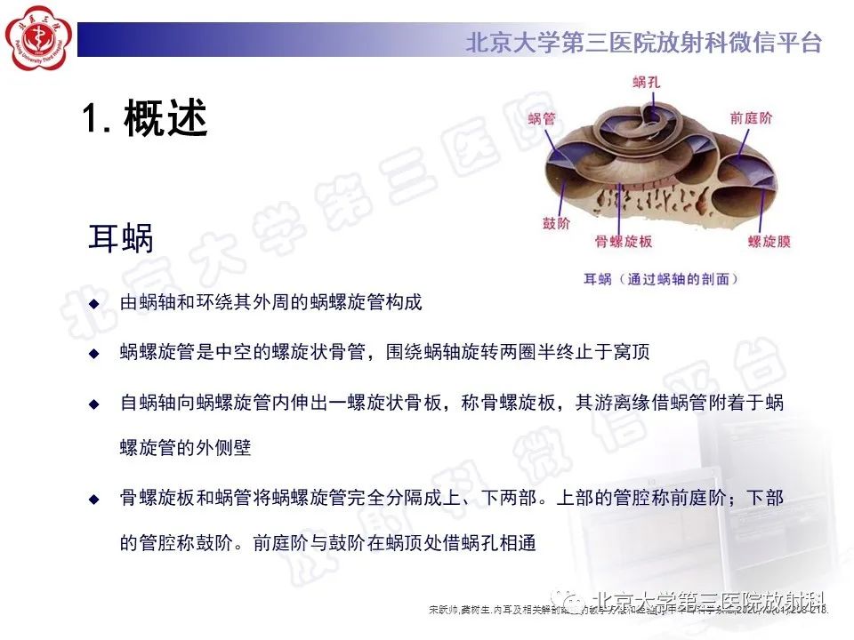 【PPT】内耳发育畸形-14