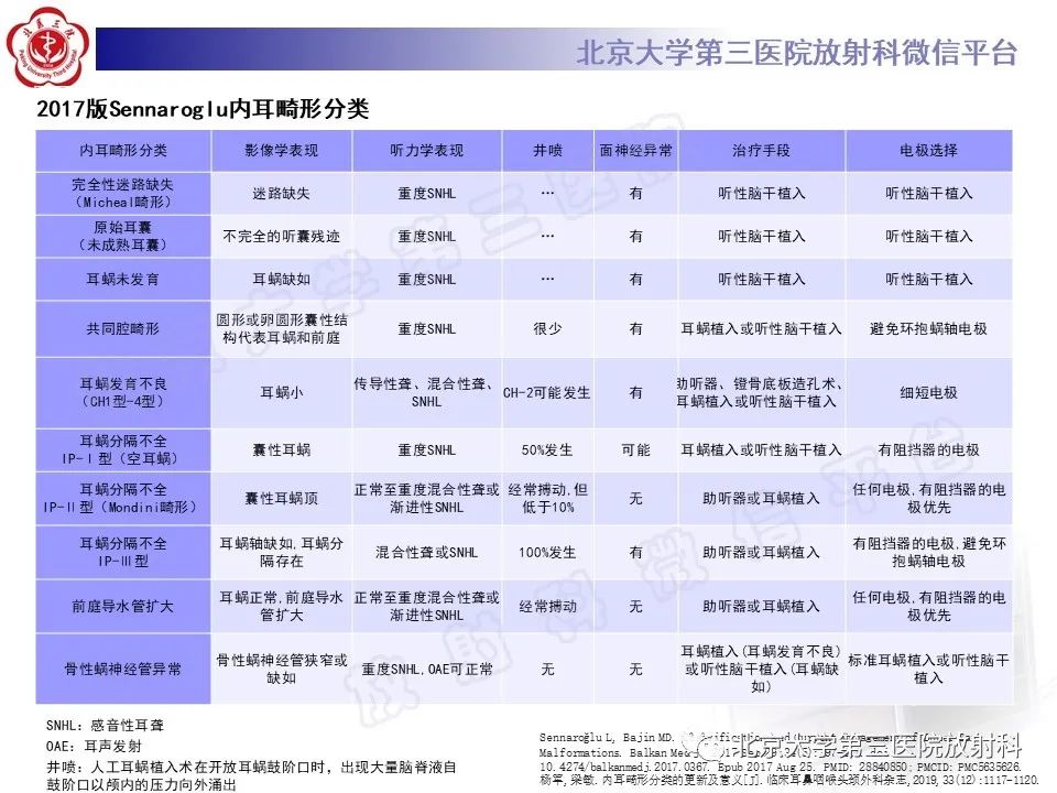 【PPT】内耳发育畸形-21