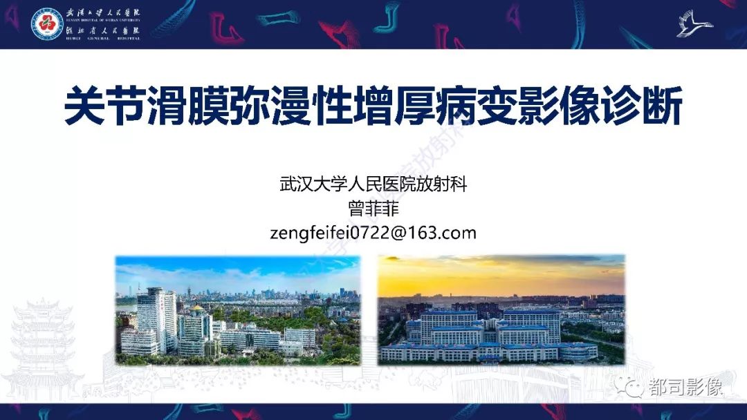 【PPT】关节滑膜弥漫性增厚病变影像诊断-1