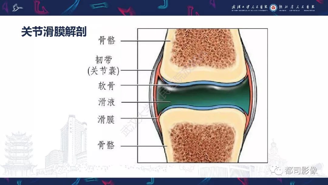 【PPT】关节滑膜弥漫性增厚病变影像诊断-3