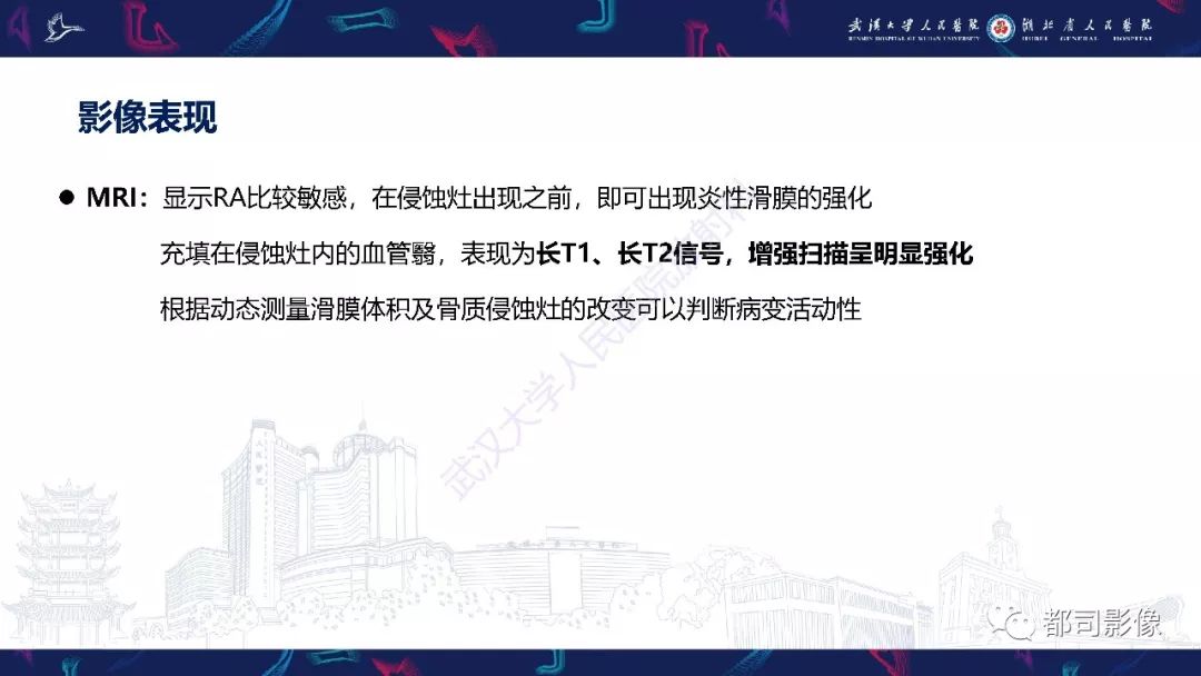 【PPT】关节滑膜弥漫性增厚病变影像诊断-11