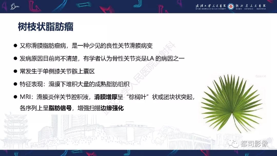 【PPT】关节滑膜弥漫性增厚病变影像诊断-25
