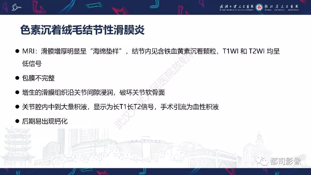 【PPT】关节滑膜弥漫性增厚病变影像诊断-29