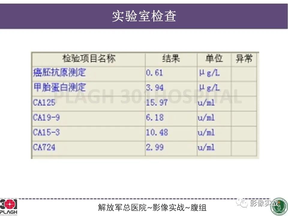 【病例】肝内胆管细胞癌1例MR影像-3