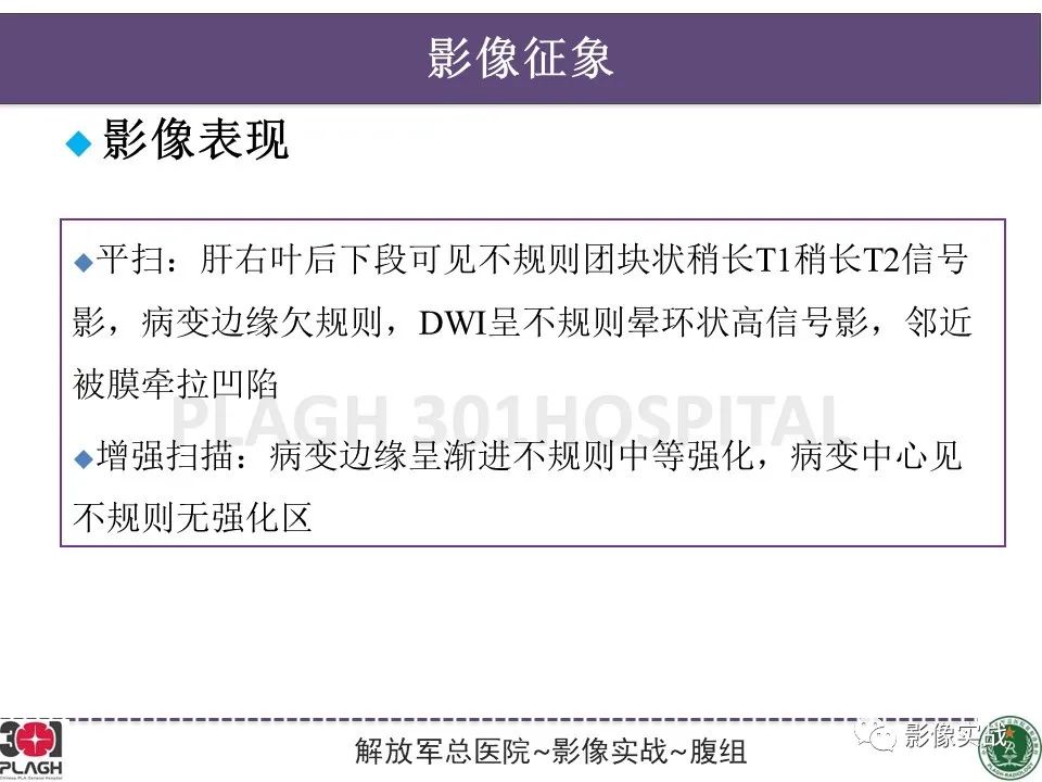 【病例】肝内胆管细胞癌1例MR影像-20