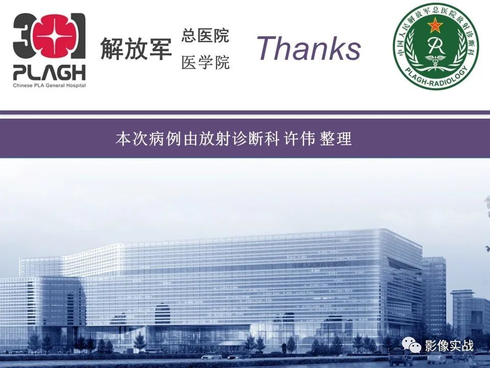 【病例】肝内胆管细胞癌1例MR影像-30