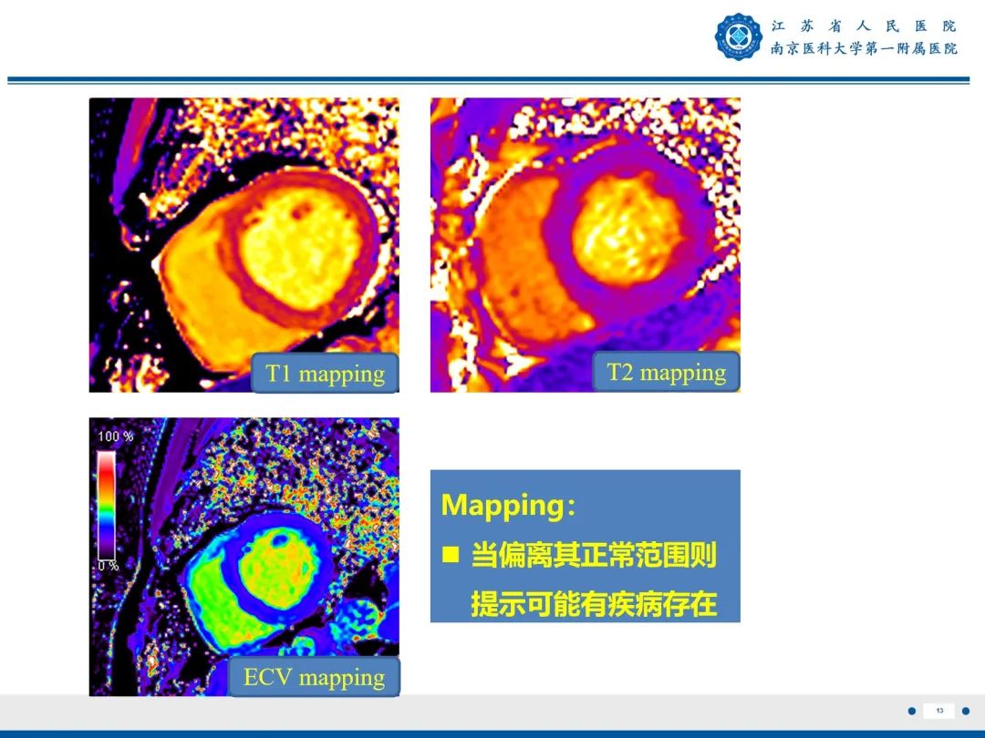 【PPT】心脏黏液瘤—心脏肿瘤MR评估-14