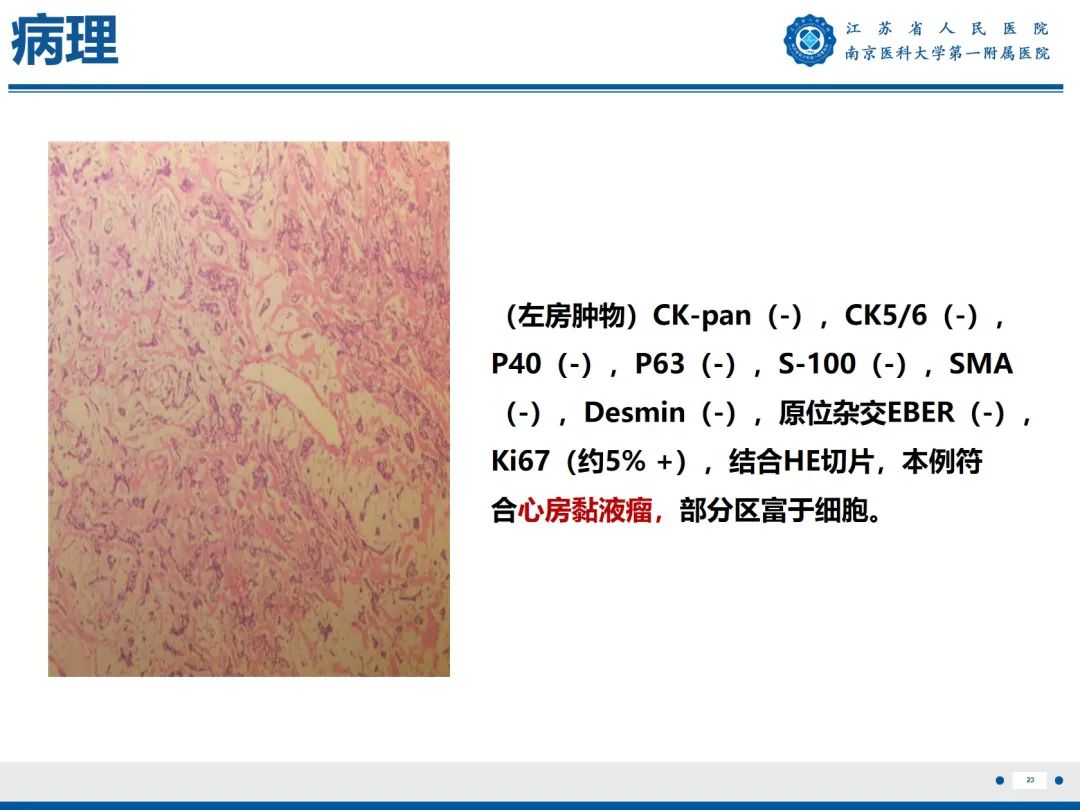 【PPT】心脏黏液瘤—心脏肿瘤MR评估-24
