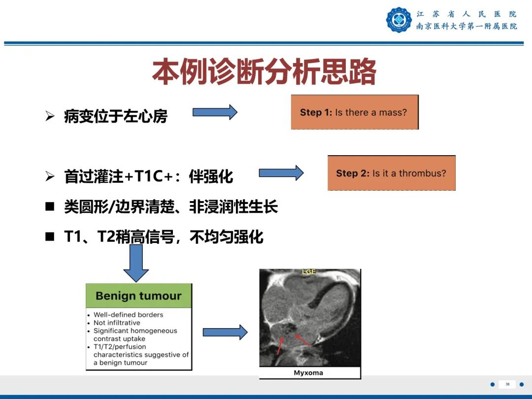 【PPT】心脏黏液瘤—心脏肿瘤MR评估-39