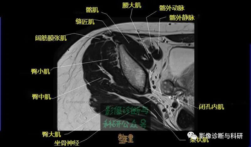 髋关节MR轴位详细标注-4 髋关节MR轴位详细标注-4