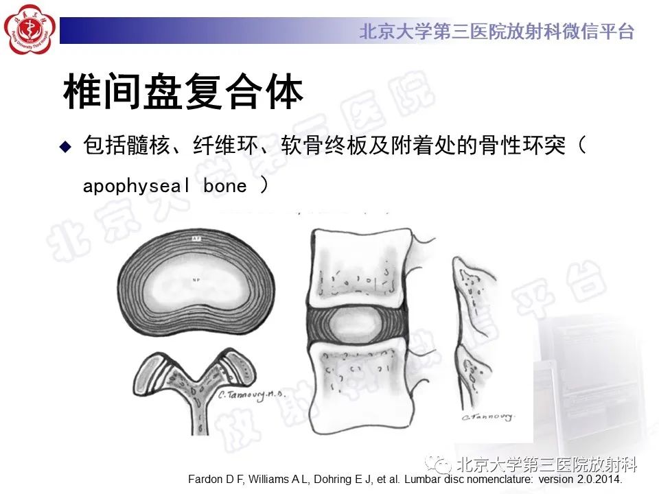 【PPT】椎间盘膨出与疝出-3