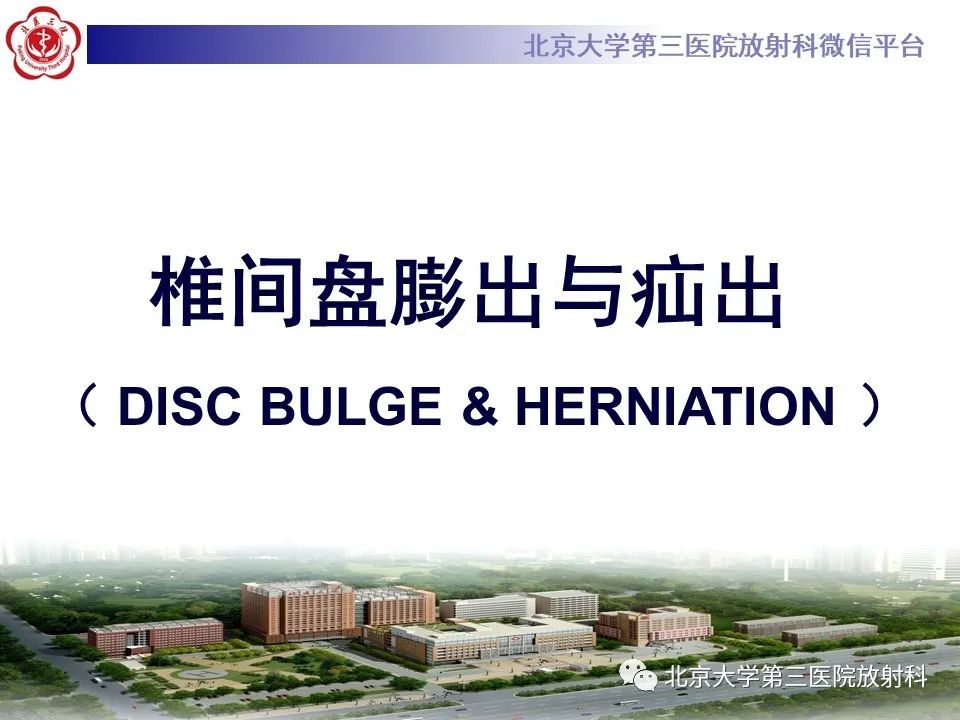 【PPT】椎间盘膨出与疝出-2