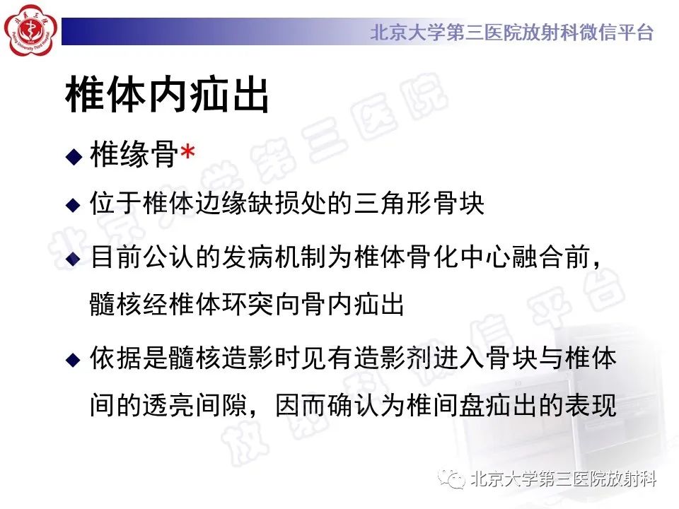 【PPT】椎间盘膨出与疝出-15