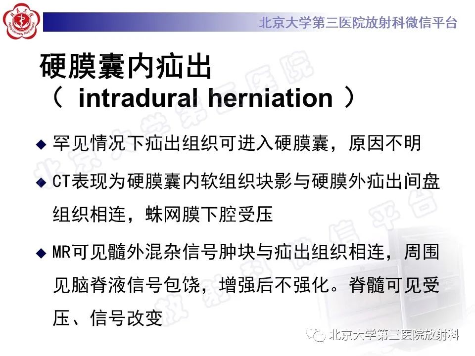 【PPT】椎间盘膨出与疝出-19
