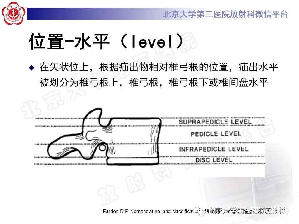 【PPT】椎间盘膨出与疝出-24