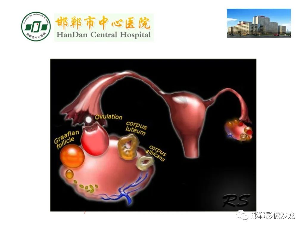 【PPT】卵巢非肿瘤性病变的影像诊断-7
