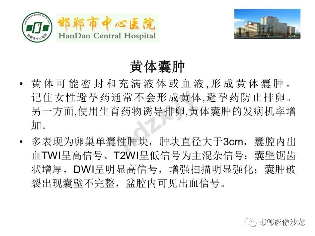 【PPT】卵巢非肿瘤性病变的影像诊断-16