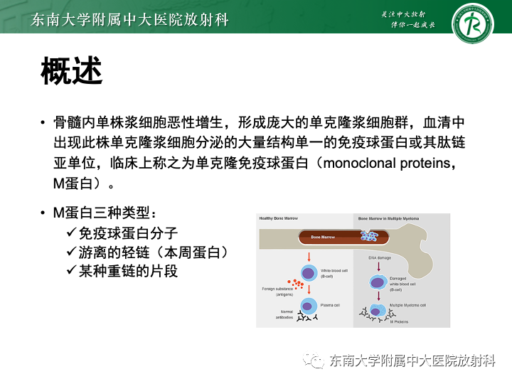 【PPT】多发性骨髓瘤-9