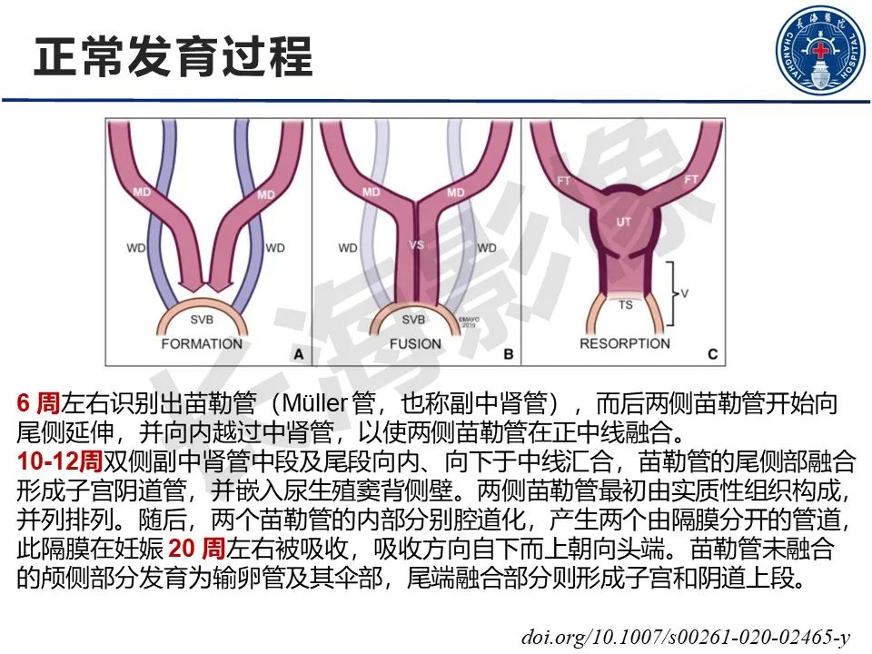 【PPT】子宫畸形的分类及MR诊断-4
