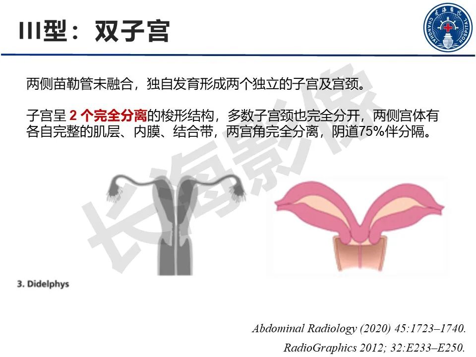 【PPT】子宫畸形的分类及MR诊断-12