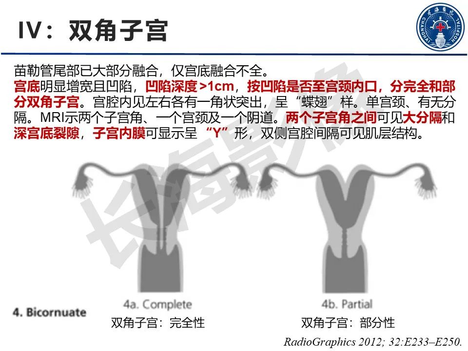 【PPT】子宫畸形的分类及MR诊断-15