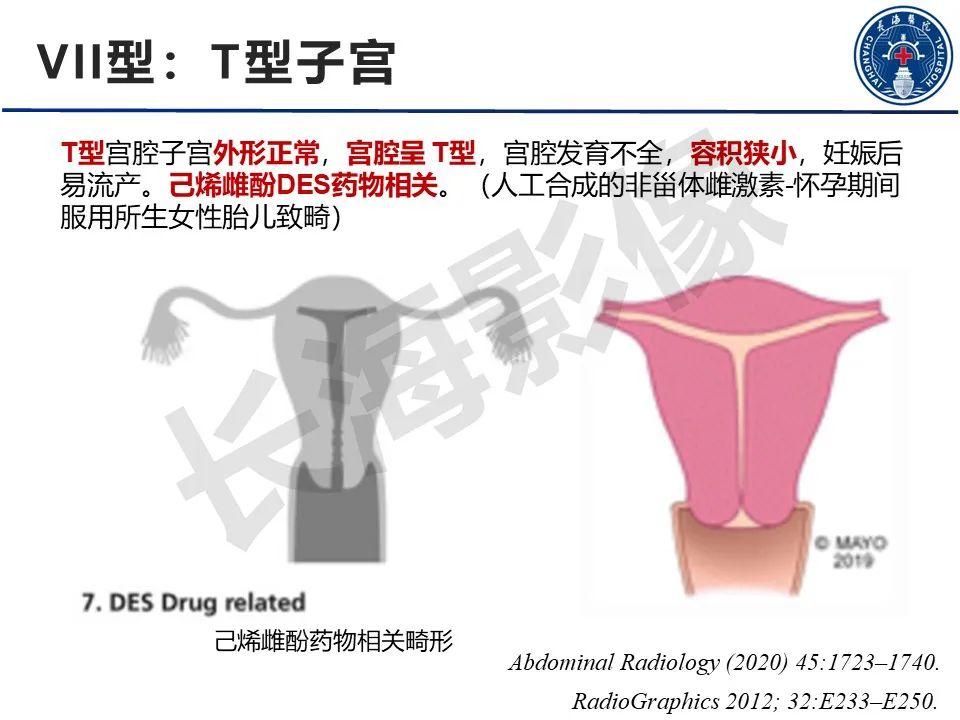 【PPT】子宫畸形的分类及MR诊断-21